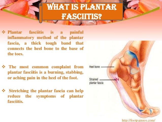 Plantar fasciitis foot pain treatment