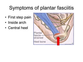 First Step Pain Plantar fasciitis presentation | PDF