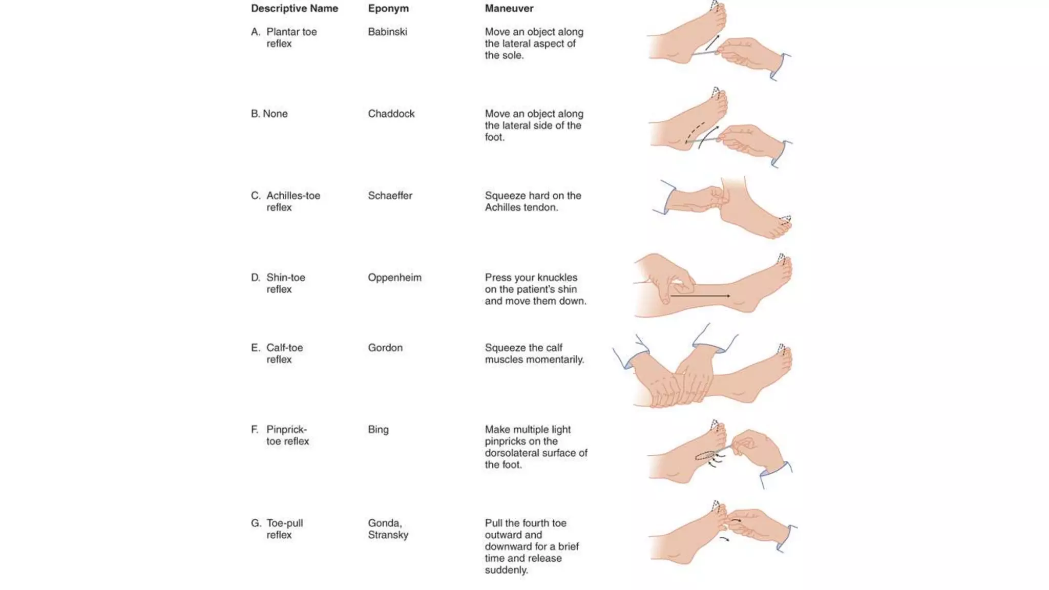 Plantar reflex | PPTX