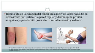  Resulta útil en la curación del cáncer en la piel y de la psoriasis. Se ha
demostrado que fortalece la pared capilar y disminuye la presión
sanguínea y que el aceite posee efecto antinflamatorio y sedante.
Teresa Valenzuela Garcia. La Ruda una planta que la rodea el misterio [sede web]. Alejandro Rojas Espinoza; 2019-03-14 [Actualizada
el 14 de marzo de 2019; acceso el 31 de enero de 2020] Disponible en: http://www.radiorebelde.cu/consejos/la-ruda-una-planta-rodea-
misterio-20190314/
 