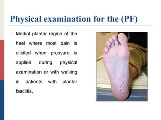 Physical examination for the (PF)
 Medial plantar region of the
heel where most pain is
elicited when pressure is
applied during physical
examination or with walking
in patients with plantar
fasciitis.
 
