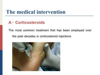 The medical intervention
A- Corticosteroids
The most common treatment that has been employed over
the past decades is corticosteroid injections
 