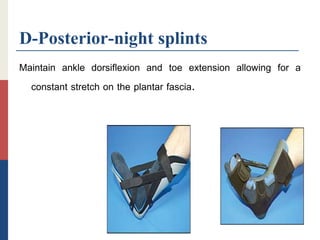 D-Posterior-night splints
Maintain ankle dorsiflexion and toe extension allowing for a
constant stretch on the plantar fascia.
 