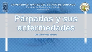 UNIVERSIDAD JUÁREZ DEL ESTADO DE DURANGO
Facultad de Medicina y Nutrición
Oftalmología
Lilia Muriel Veloz Sanabria
 