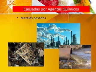 Causadas por Agentes Químicos
• Metales pesados
 
