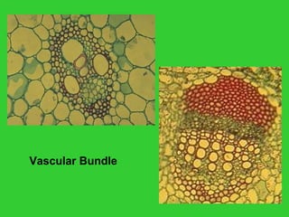 Vascular Bundle
 