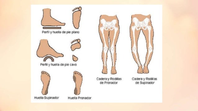 plantografa y tipos de pies 25 638