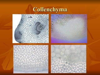 Collenchyma 