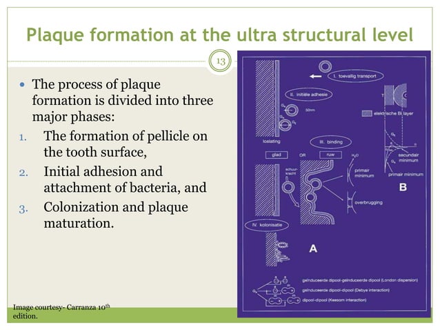 Plaque PPT