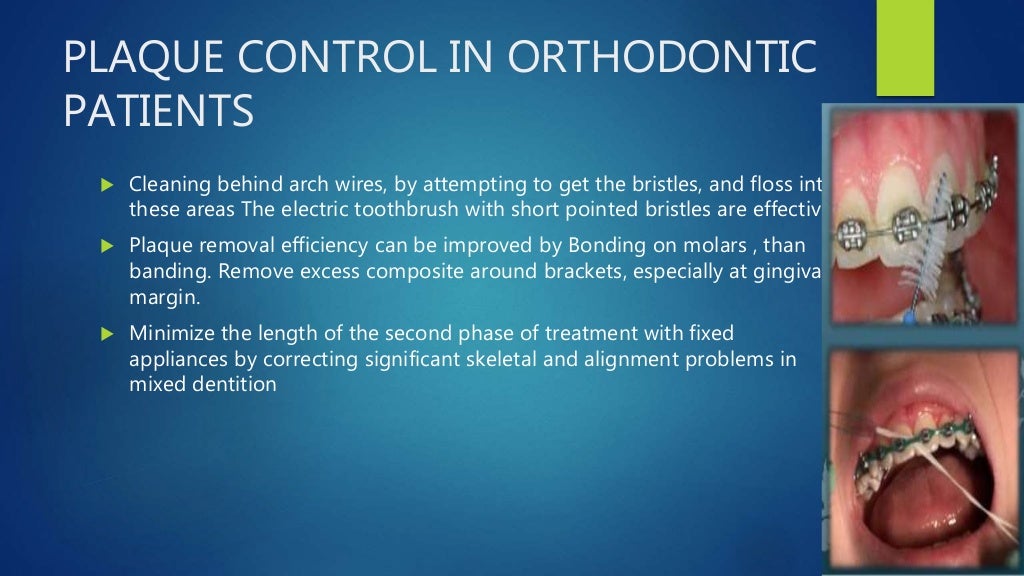 mechanisms of Plaque control