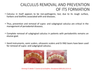 Plaque as a Biofilm | PPTX