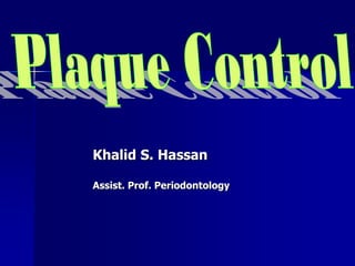 Khalid S. Hassan
Assist. Prof. Periodontology
 