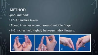 METHOD
Spool method:
• 12-18 inches taken
• About 4 inches wound around middle finger
• 1-2 inches held tightly between index fingers.
 