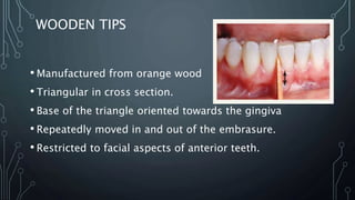 WOODEN TIPS
• Manufactured from orange wood
• Triangular in cross section.
• Base of the triangle oriented towards the gingiva
• Repeatedly moved in and out of the embrasure.
• Restricted to facial aspects of anterior teeth.
 