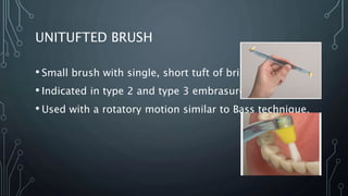 UNITUFTED BRUSH
• Small brush with single, short tuft of bristles.
• Indicated in type 2 and type 3 embrasures.
• Used with a rotatory motion similar to Bass technique.
 