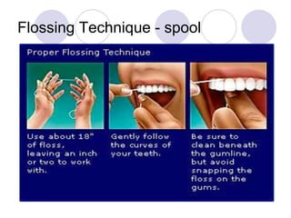 Flossing Technique - spool
 