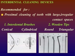 INTERDENTAL CLEANING DEVICES
Recommended for :
Proximal cleaning of teeth with large,irregular
contact spaces
1. Interdental Brushes 2. Wooden Tips
Conical Cylindrical Round Triangular
 