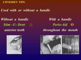 2.WOODEN TIPS
Used with or without a handle
Without a handle With a handle
Stim –U- Dent Perio-Aid O
anterior teeth throughout the mouth
 