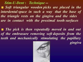 Stim-U-Dent : Technique --
Soft triangular wooden picks are placed in the
interdental space in such a way that the base of
the triangle rests on the gingiva and the sides
are in contact with the proximal tooth surfaces
The pick is then repeatedly moved in and out
of the embrasure removing soft deposits from the
teeth and mechanically stimulating the papillary
gingiva
 