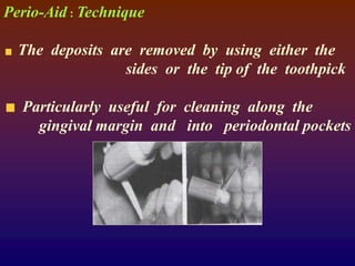 Perio-Aid : Technique
The deposits are removed by using either the
sides or the tip of the toothpick
Particularly useful for cleaning along the
gingival margin and into periodontal pockets
 