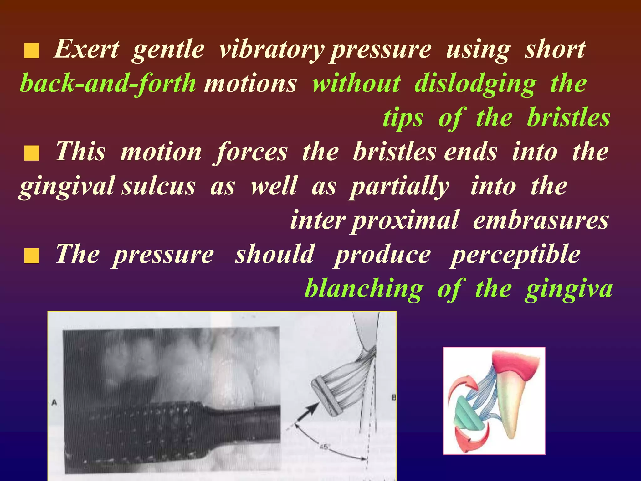 Exert gentle vibratory pressure using short
back-and-forth motions without dislodging the
tips of the bristles
This motion forces the bristles ends into the
gingival sulcus as well as partially into the
inter proximal embrasures
The pressure should produce perceptible
blanching of the gingiva
 