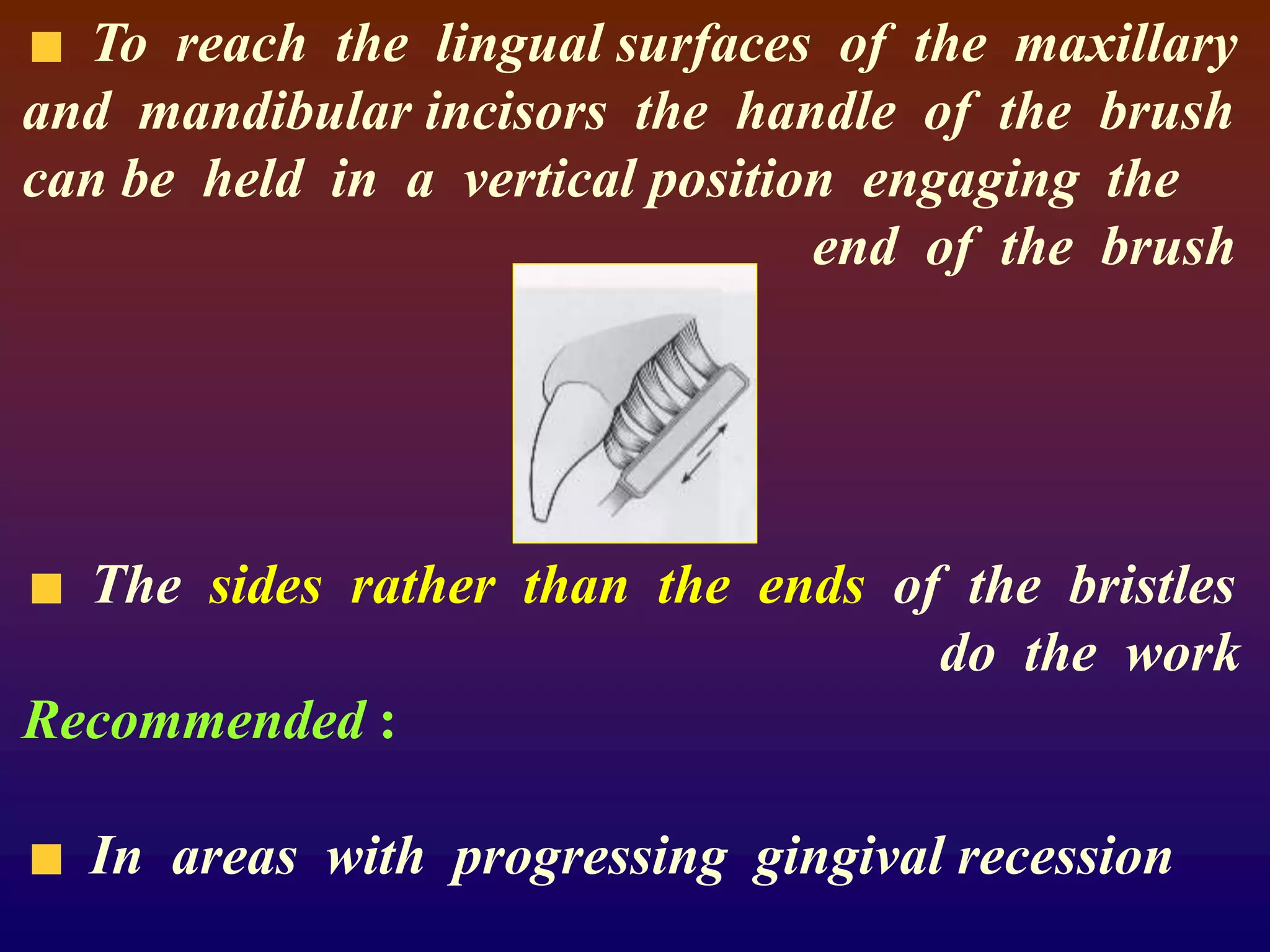 To reach the lingual surfaces of the maxillary
and mandibular incisors the handle of the brush
can be held in a vertical position engaging the
end of the brush
The sides rather than the ends of the bristles
do the work
Recommended :
In areas with progressing gingival recession
 