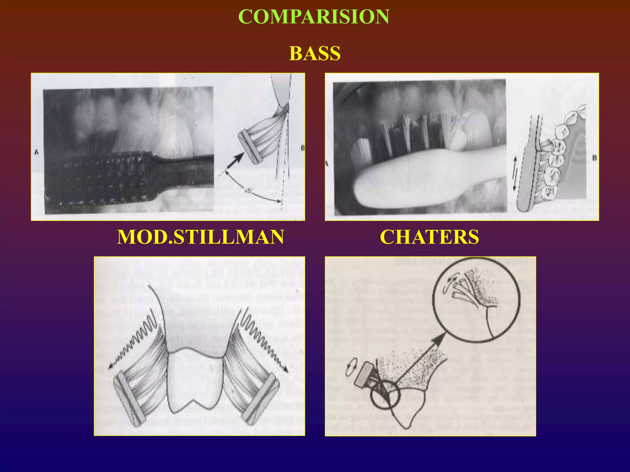 COMPARISION
BASS
MOD.STILLMAN CHATERS
 