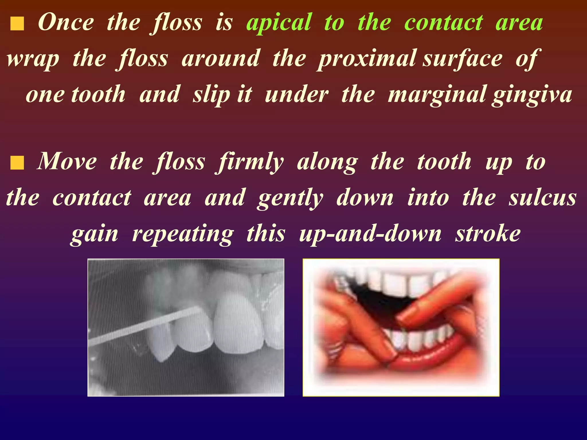 Once the floss is apical to the contact area
wrap the floss around the proximal surface of
one tooth and slip it under the marginal gingiva
Move the floss firmly along the tooth up to
the contact area and gently down into the sulcus
gain repeating this up-and-down stroke
 
