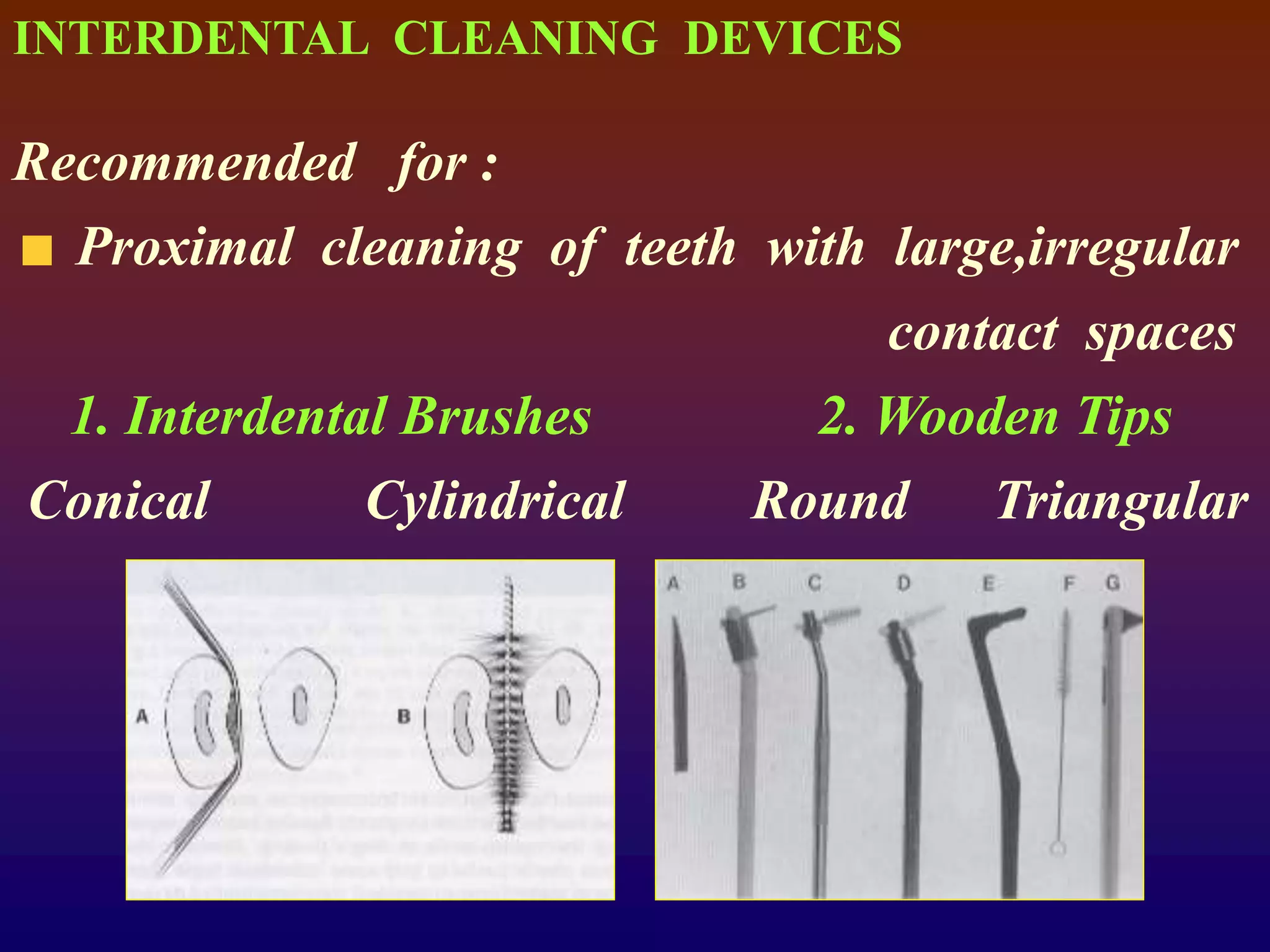 INTERDENTAL CLEANING DEVICES
Recommended for :
Proximal cleaning of teeth with large,irregular
contact spaces
1. Interdental Brushes 2. Wooden Tips
Conical Cylindrical Round Triangular
 