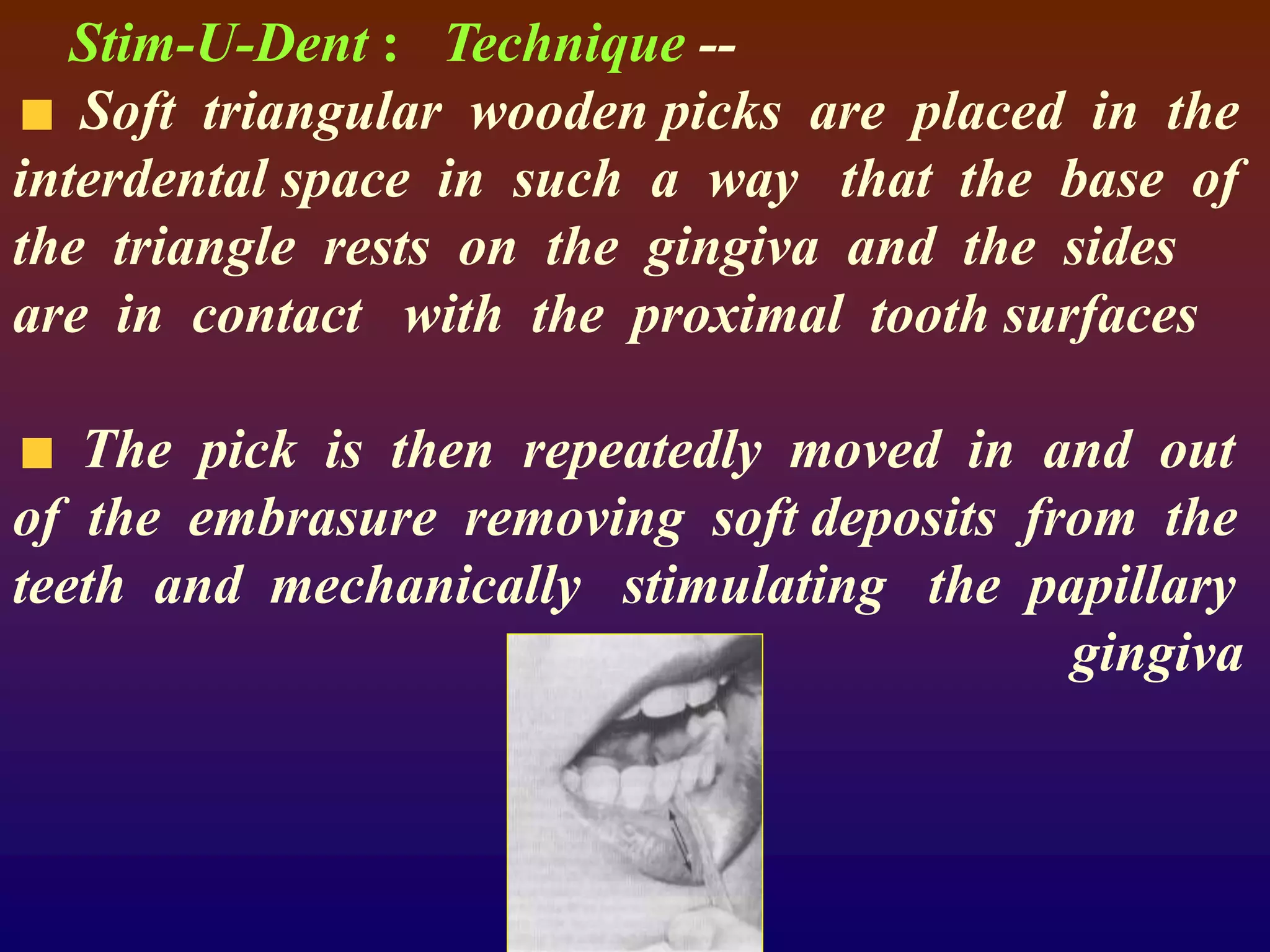 Stim-U-Dent : Technique --
Soft triangular wooden picks are placed in the
interdental space in such a way that the base of
the triangle rests on the gingiva and the sides
are in contact with the proximal tooth surfaces
The pick is then repeatedly moved in and out
of the embrasure removing soft deposits from the
teeth and mechanically stimulating the papillary
gingiva
 
