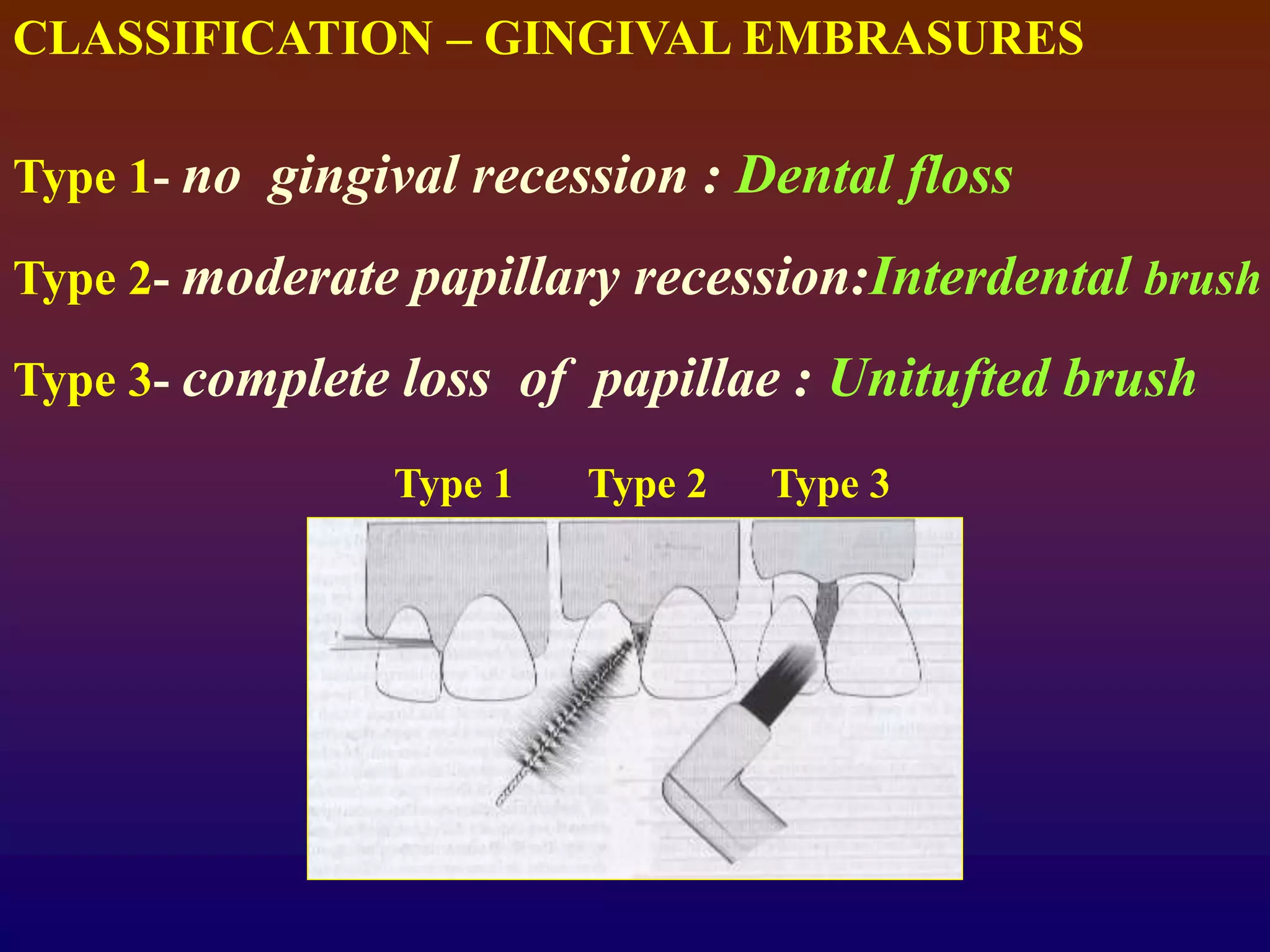 CLASSIFICATION – GINGIVAL EMBRASURES
Type 1- no gingival recession : Dental floss
Type 2- moderate papillary recession:Interdental brush
Type 3- complete loss of papillae : Unitufted brush
Type 1 Type 2 Type 3
 