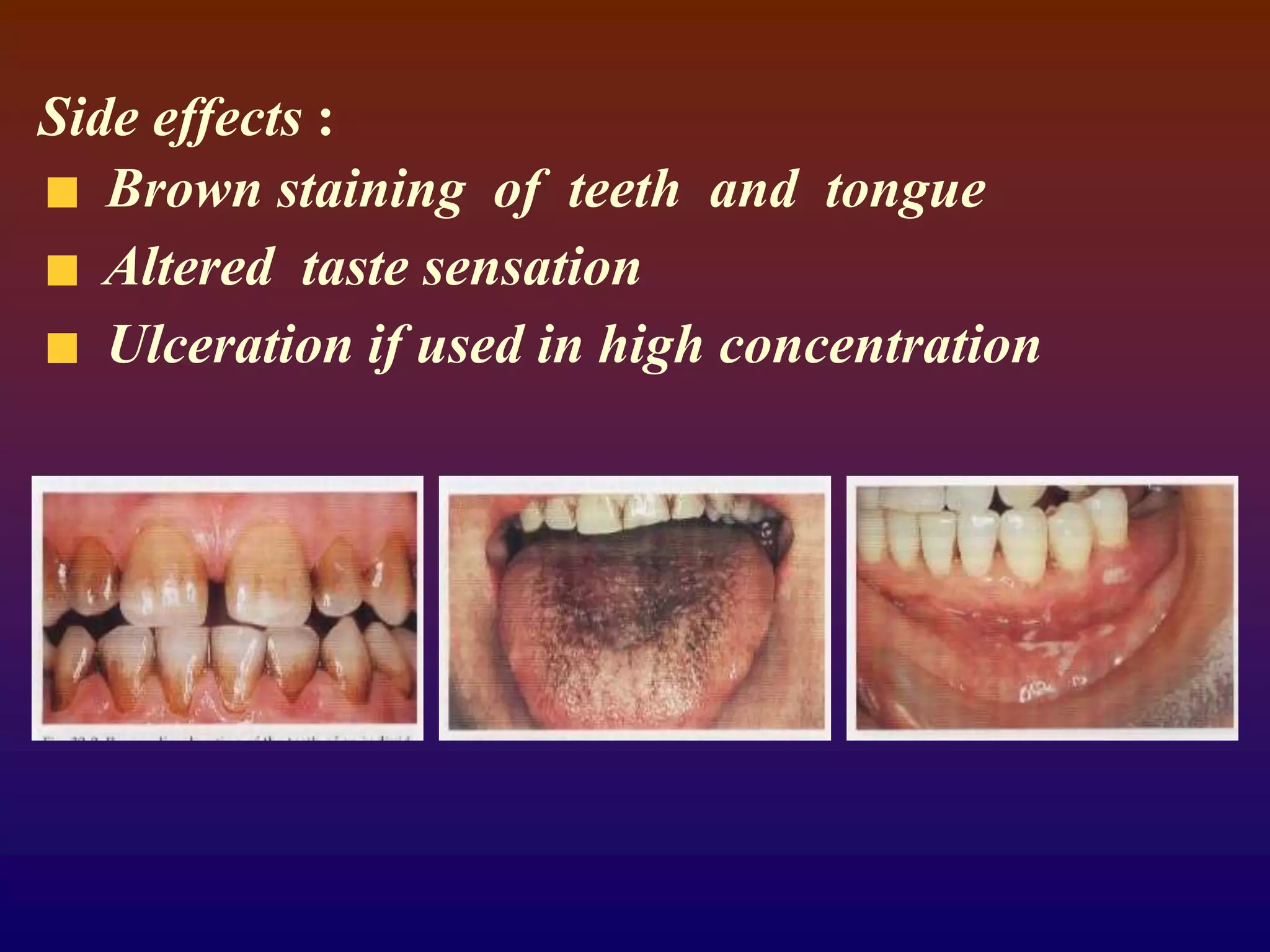 Side effects :
Brown staining of teeth and tongue
Altered taste sensation
Ulceration if used in high concentration
 
