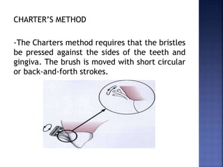 CHARTER’S METHOD
-The Charters method requires that the bristles
be pressed against the sides of the teeth and
gingiva. The brush is moved with short circular
or back-and-forth strokes.
 