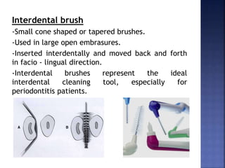 Interdental brush
-Small cone shaped or tapered brushes.
-Used in large open embrasures.
-Inserted interdentally and moved back and forth
in facio - lingual direction.
-Interdental brushes represent the ideal
interdental cleaning tool, especially for
periodontitis patients.
 