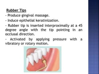 Rubber Tips
- Produce gingival massage.
- Induce epithelial keratinization.
- Rubber tip is inserted interproximally at a 45
degree angle with the tip pointing in an
occlusal direction.
- Activated by applying pressure with a
vibratory or rotary motion.
 