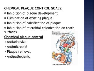 CHEMICAL PLAQUE CONTROL GOALS:
Inhibition of plaque development
Elimination of existing plaque
Inhibition of calcification of plaque
Inhibition of microbial colonization on tooth
surfaces
Chemical plaque control
• Antiadhesive
• Antimicrobial
• Plaque removal
• Antipathogenic
 