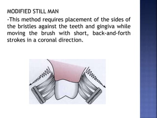 MODIFIED STILL MAN
-This method requires placement of the sides of
the bristles against the teeth and gingiva while
moving the brush with short, back-and-forth
strokes in a coronal direction.
 