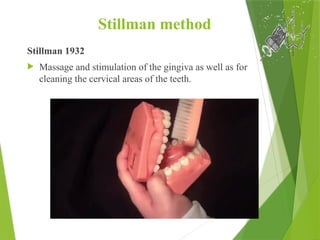 Stillman method
Stillman 1932
 Massage and stimulation of the gingiva as well as for
cleaning the cervical areas of the teeth.
 