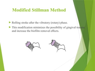 Modified Stillman Method
 Rolling stroke after the vibratory (rotary) phase.
 This modification minimizes the possibility of gingival trauma
and increase the biofilm removal effects.
 