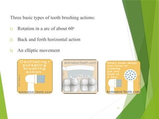 Three basic types of tooth brushing actions:
1) Rotation in a arc of about 60o
2) Back and forth horizontal action
3) An elliptic movement
45
 