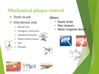 Mechanical plaque control
 Tooth brush
 Interdental aids
 Dental floss
 Triangular tooth picks
 Interdental brushes
 Single tufted brushes
 Yarn
 Perioaid
Others
• Gauze strips
• Pipe cleaners
• Water irrigation device
 