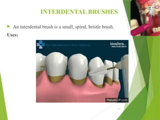 INTERDENTAL BRUSHES
 An interdental brush is a small, spiral, bristle brush.
Uses:
61
 