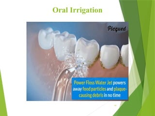 Oral Irrigation
64
 