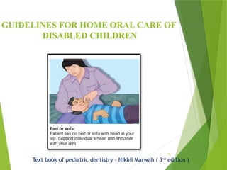 75
GUIDELINES FOR HOME ORAL CARE OF
DISABLED CHILDREN
Text book of pediatric dentistry – Nikhil Marwah ( 3rd
edition )
 