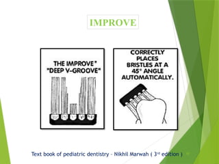 80
IMPROVE
Text book of pediatric dentistry – Nikhil Marwah ( 3rd
edition )
 