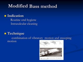 Modified
 Indication
Routine oral hygiene
Intrasulcular cleaning
 Technique
combination of vibratory motion and sweeping
motion
Bass method
 