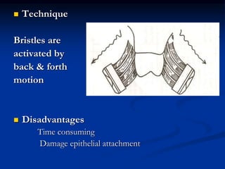  Technique
Bristles are
activated by
back & forth
motion
 Disadvantages
Time consuming
Damage epithelial attachment
 