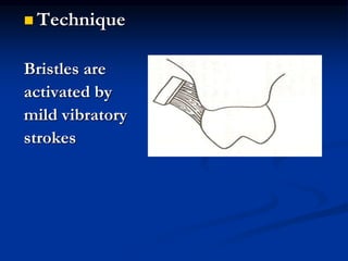  Technique
Bristles are
activated by
mild vibratory
strokes
 