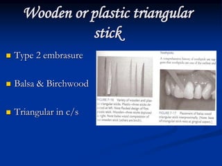 Wooden or plastic triangular
stick
 Type 2 embrasure
 Balsa & Birchwood
 Triangular in c/s
 