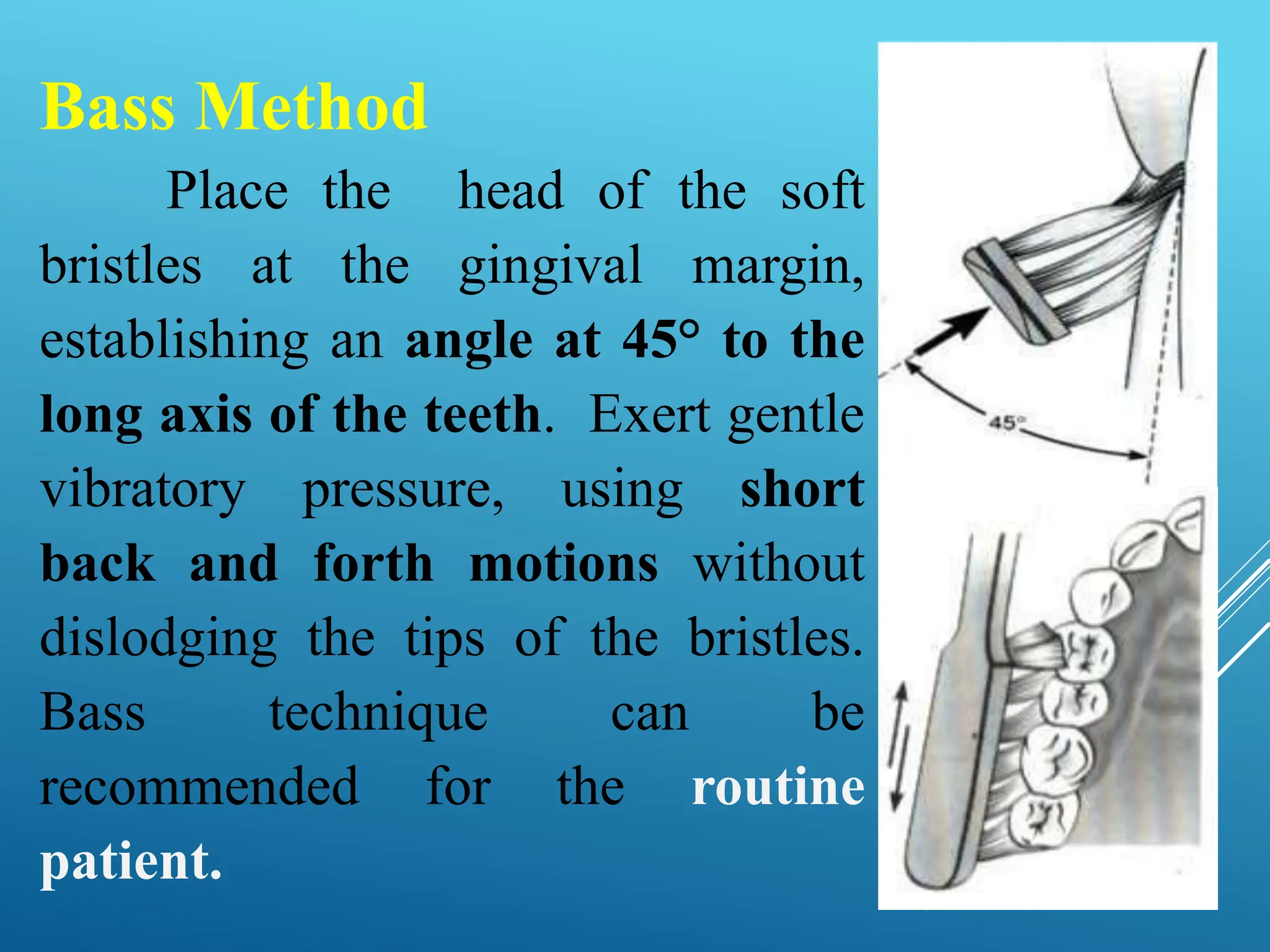 Bass Method
Place the head of the soft
bristles at the gingival margin,
establishing an angle at 45° to the
long axis of the teeth. Exert gentle
vibratory pressure, using short
back and forth motions without
dislodging the tips of the bristles.
Bass technique can be
recommended for the routine
patient.
 